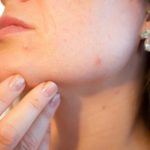 Tips for Those With Oily Skin thumbnail